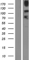 KDM4B Human Over-expression Lysate