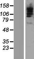 TBC1D9B Human Over-expression Lysate