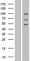 ENDOD1 Human Over-expression Lysate