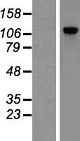 POP1 Human Over-expression Lysate