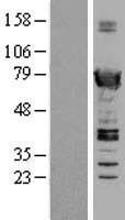 SWAP70 Human Over-expression Lysate