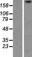 PARC (CUL9) Human Over-expression Lysate