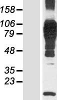 N4BP3 Human Over-expression Lysate
