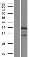 DCUN1D4 Human Over-expression Lysate