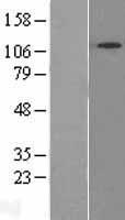 SNX13 Human Over-expression Lysate