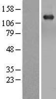 TBC1D1 Human Over-expression Lysate