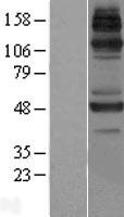 JMJD6 Human Over-expression Lysate