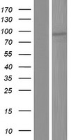 TBC1D12 Human Over-expression Lysate
