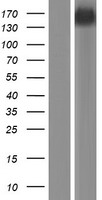 TENC1 (TNS2) Human Over-expression Lysate