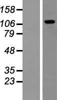 Pumilio 2 (PUM2) Human Over-expression Lysate
