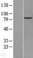 SUZ12 Human Over-expression Lysate