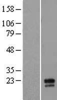 MD2 (LY96) Human Over-expression Lysate