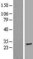TMEM186 Human Over-expression Lysate