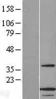ANAPC13 Human Over-expression Lysate