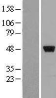 ZNF385 (ZNF385A) Human Over-expression Lysate