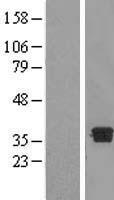 DHRS7B Human Over-expression Lysate