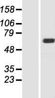 MOXD1 Human Over-expression Lysate