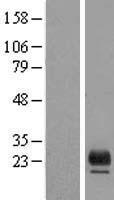 TMEM98 Human Over-expression Lysate