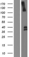LRIG1 Human Over-expression Lysate