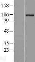 ZZZ3 Human Over-expression Lysate