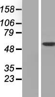 DAK (TKFC) Human Over-expression Lysate
