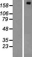 SIPA1L1 Human Over-expression Lysate