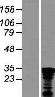 C1orf77 (CHTOP) Human Over-expression Lysate