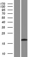 TBC1D29P Human Over-expression Lysate