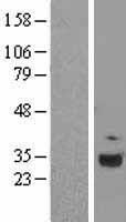 C1QA Human Over-expression Lysate