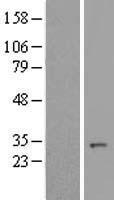 C14orf166 (RTRAF) Human Over-expression Lysate