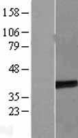 ETV7 Human Over-expression Lysate