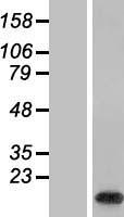 C19orf56 (WDR83OS) Human Over-expression Lysate