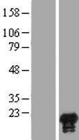 JPT1 Human Over-expression Lysate