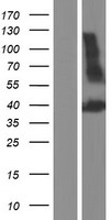 PDGFC Human Over-expression Lysate