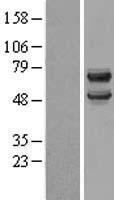 DCDC2 Human Over-expression Lysate
