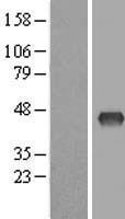 ZDHHC2 Human Over-expression Lysate