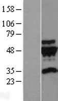 gamma Tubulin (TUBG2) Human Over-expression Lysate