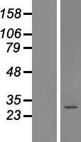 COPZ2 Human Over-expression Lysate