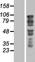 GTSE1 Human Over-expression Lysate