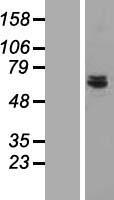 CDK5RAP1 Human Over-expression Lysate