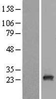 RAB9B Human Over-expression Lysate