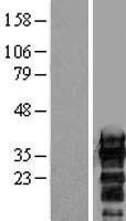 ZCCHC17 Human Over-expression Lysate