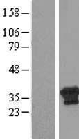 CXorf26 (PBDC1) Human Over-expression Lysate