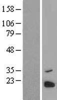 MTRES1 Human Over-expression Lysate