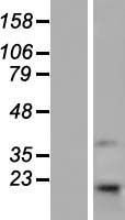 TMEM69 Human Over-expression Lysate