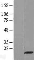 PDZD11 Human Over-expression Lysate