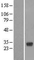 RBJ (DNAJC27) Human Over-expression Lysate
