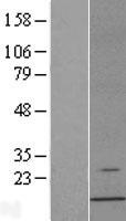 AHSP Human Over-expression Lysate