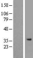 SPG21 Human Over-expression Lysate