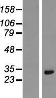 KRCC1 Human Over-expression Lysate